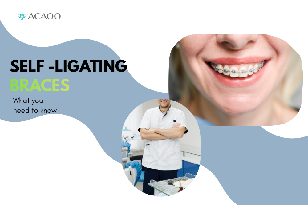 Self -ligating braces What you need to know